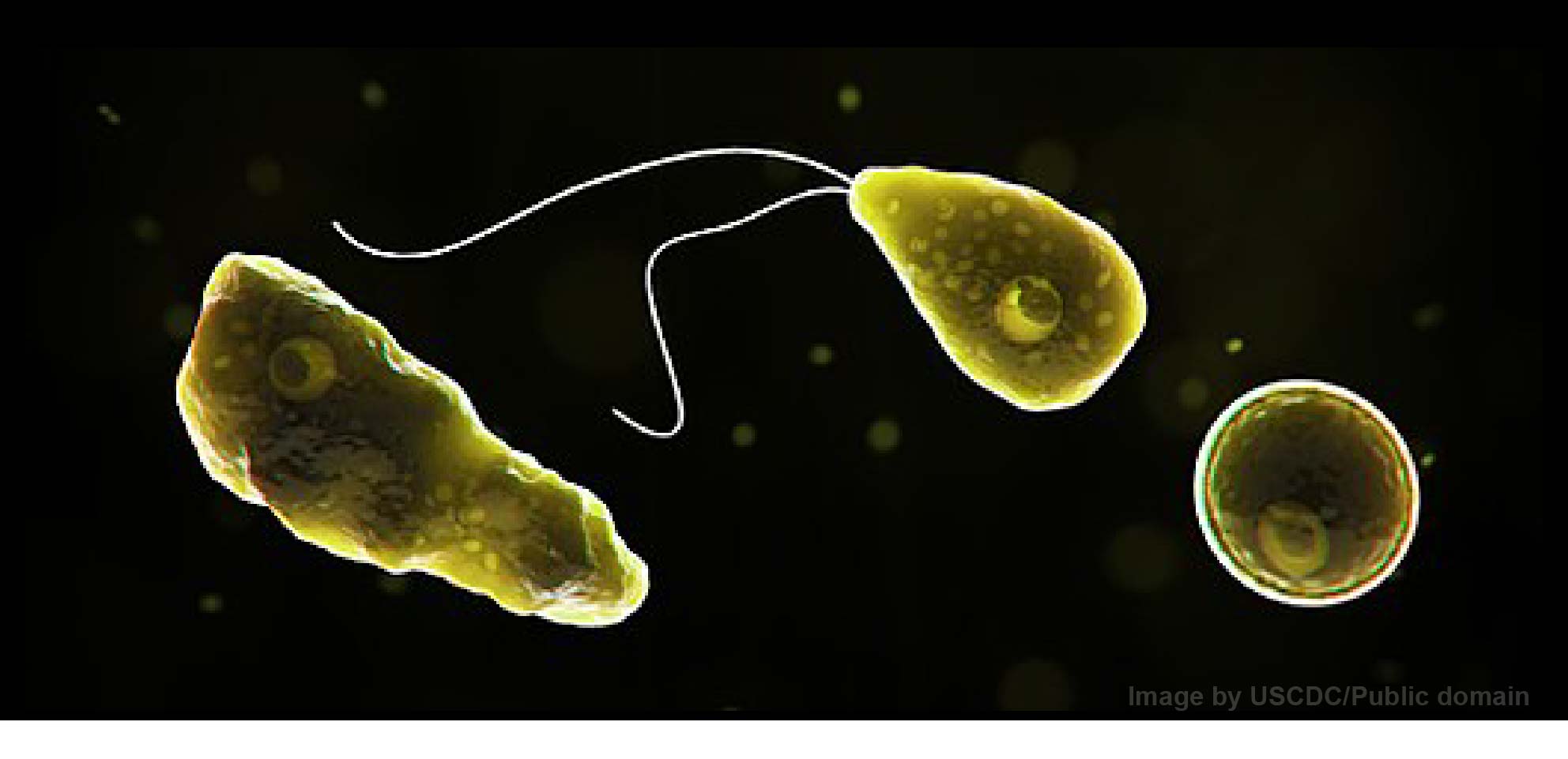 Roof-harvested rainwater poses risk of hosting brain-eating amoeba “Naegleria fowleri”